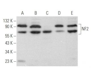 Neurofibromin 2/NF2/Merlin Antibody (E-2) - Western Blotting - Image 355825 