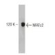 NFATc2 Antibody (1) - Western Blotting - Image 127512