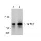 NFATc2 Antibody (A-2) - Western Blotting - Image 379213