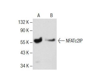 NFATc2IP Antibody (B-1) - Western Blotting - Image 285011 