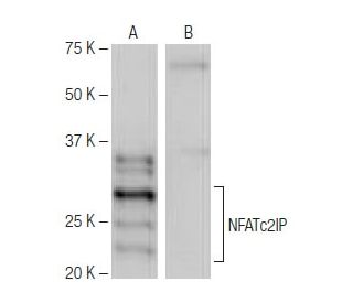NFATc2IP Antibody (FT-113) - Western Blotting - Image 65017