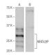 NFATc2IP Antibody (FT-113) - Western Blotting - Image 65017