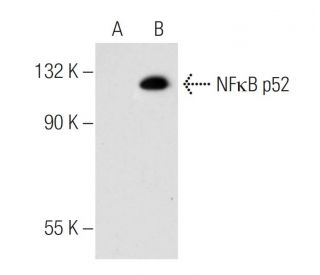 NF&kappa;B p52/p100/NFKB2 Antibody (C-5) - Western Blotting - Image 53112Each CRISPR/Cas9 Knockout (KO) Plasmid product consists of a pool of 3 plasmids designed to ensure identification and cleavage of a specific gene for maximum knockout efficiency. Each plasmid encodes a unique 20 nt sequence derived from the GeCKO (v2) library. 