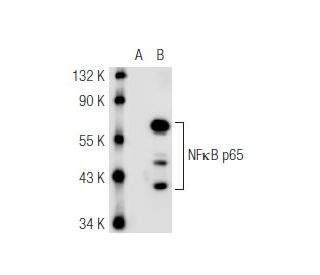 RELA/NF&kappa;B p65 Antibody (4H212) - Western Blotting - Image 45534 