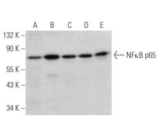RELA/NF&kappa;B p65 Antibody (E-5) - Western Blotting - Image 333754 