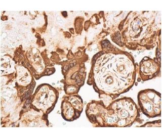 RELA/NF&kappa;B p65 Antibody (G-8) - Immunohistochemistry - Image 357864 