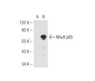 NF kappa B p65 (4H211): sc-71675. Western blot analysis of NF kappa B p65... 
