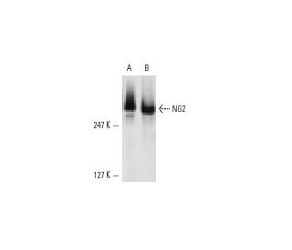 NG2 Antibody (132.38) - Western Blotting - Image 10837 