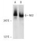 NG2 Antibody (132.38) - Western Blotting - Image 10837 