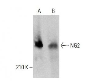 NG2 Antibody (5H26) - Western Blotting - Image 377949 