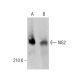 NG2 Antibody (5H26) - Western Blotting - Image 377949 