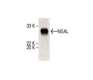 NGAL Antibody (H-4) - Western Blotting - Image 395669SAM Transcription Activation: SAM system utilizing dCas9-VP64, MS2-P65-HSF1, and sgRNA for precise gene transcription activation.
