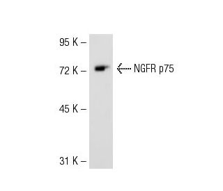 NGFR p75 Antibody (5H1) - Western Blotting - Image 53549