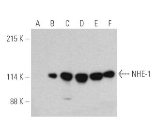 NHE-1 Antibody (A-2) - Western Blotting - Image 389705 