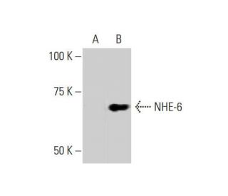 NHE-6 Antibody (2D5) - Western Blotting - Image 352175 