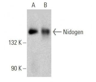 Nidogen Antibody (2Q583) - Western Blotting - Image 358626 
