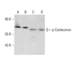 NIH/3T3 + anisomycin Cell Lysate: Western blot analysis of Caldesmon... 