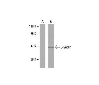 NIH/3T3 + forskolin Cell Lysate: sc-24741. Western blot analysis of...
