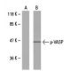 NIH/3T3 + forskolin Cell Lysate: sc-24741. Western blot analysis of...