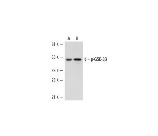 NIH/3T3 + PDGF Cell Lysate: sc-3803. Western blot analysis of... 