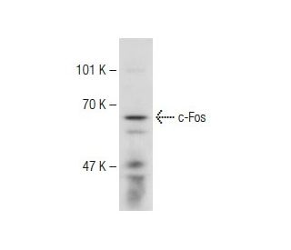 NIH/3T3 + serum Cell Lysate: sc-2248. Western blot analysis of... 