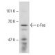 NIH/3T3 + serum Cell Lysate: sc-2248. Western blot analysis of... 
