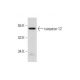 NIH/3T3 + UV Cell Lysate: sc-3804. Western blot analysis of...