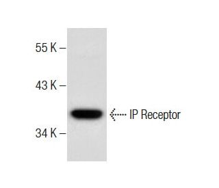 IP Receptor (M-20): sc-20438. Western blot analysis of IP Receptor expression in NIH/3T3 whole cell lysate. 