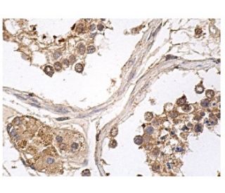 NIK Antibody (A-12) - Immunohistochemistry - Image 156686 