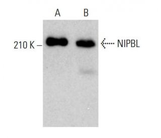NIPBL Antibody (C-9) - Western Blotting - Image 376076SAM Transcription Activation: SAM system utilizing dCas9-VP64, MS2-P65-HSF1, and sgRNA for precise gene transcription activation.