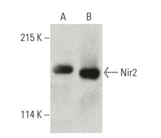 Nir2 Antibody (8) - Western Blotting - Image 396398The Double Nickase Plasmid features a U6 promoter for sgRNA expression, a 20 nt targeting sequence, and a gRNA scaffold to guide Cas9n. It includes a CBh promoter for Cas9n (D10A) and puromycin resistance, GFP for transfection verification, and nuclear localization signals (NLS). The 2A peptide allows co-expression of Cas9n and Puro from a single promoter, enabling precise genome editing with reduced off-target effects.