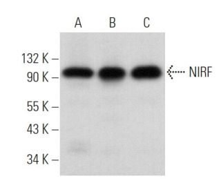 NIRF Antibody (C-10) - Western Blotting - Image 360657Each CRISPR/Cas9 Knockout (KO) Plasmid product consists of a pool of 3 plasmids designed to ensure identification and cleavage of a specific gene for maximum knockout efficiency. Each plasmid encodes a unique 20 nt sequence derived from the GeCKO (v2) library. 