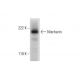 Nischarin Antibody (G-3) - Western Blotting - Image 297612