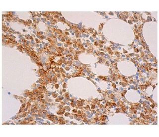 nitrated alpha/beta Synuclein Antibody (Syn12) - Immunohistochemistry - Image 350534 
