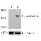 nitrated Tau Antibody (Tau-nY29) - Western Blotting - Image 413242