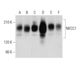 NKCC1 Antibody (F-4) - Western Blotting - Image 333388Each CRISPR/Cas9 Knockout (KO) Plasmid product consists of a pool of 3 plasmids designed to ensure identification and cleavage of a specific gene for maximum knockout efficiency. Each plasmid encodes a unique 20 nt sequence derived from the GeCKO (v2) library. 