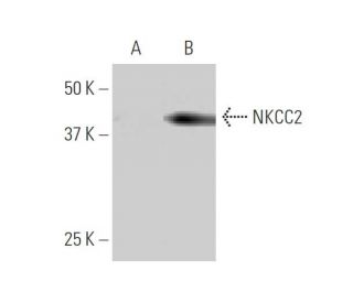 NKCC2 Antibody (4H4) - Western Blotting - Image 347578 