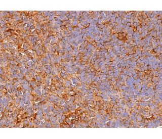 NKG2-D Antibody (A-7) - Immunohistochemistry - Image 374765 