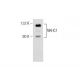 NKHC1 Antibody (G-1) - Western Blotting - Image 155419