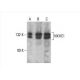NKHC1 Antibody (G-1) - Western Blotting - Image 392995 