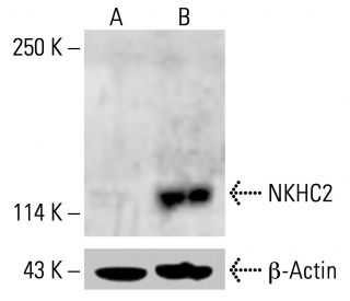 NKHC2 Antibody (B-9) - Western Blotting - Image 414582 