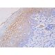 NKp30 Antibody (CLH9) - Immunohistochemistry - Image 385992 