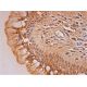 Nlk Antibody (B-5) - Immunohistochemistry - Image 293412 