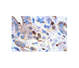 nm23-H1 Antibody (NM301) - Immunohistochemistry - Image 8095 
