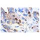 nm23-H1 Antibody (NM301) - Immunohistochemistry - Image 8095 