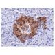 nm23-H1 Antibody (NM301) - Immunohistochemistry - Image 156838
