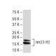 nm23-H2 Antibody (X-42) - Western Blotting - Image 33776