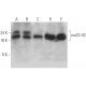 nm23-H2 Antibody (X-42) - Western Blotting - Image 368208 