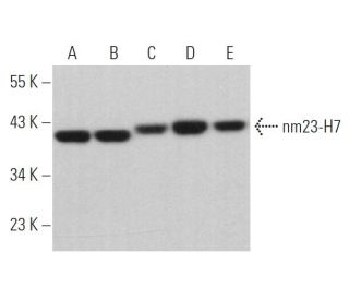 nm23-H7 Antibody (B-9) - Western Blotting - Image 372982 