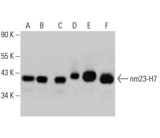 nm23-H7 Antibody (F-7) - Western Blotting - Image 384523 